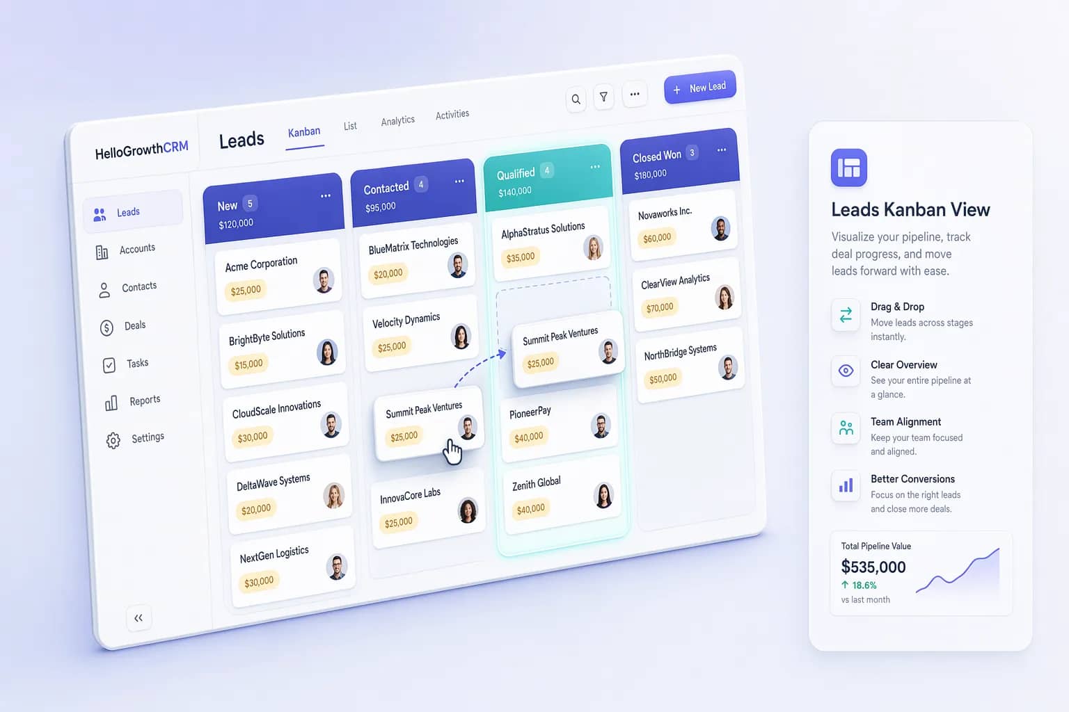 Leads Kanban View